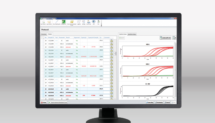 EURORealTime Analysis